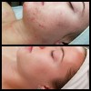 Renu Skin Spa