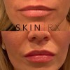 Skin Rx