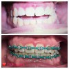 Gem Orthodontics