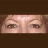 Eyebrow Renovation & Permanent Makeup