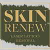 Skin Renew Laser Tattoo Removal & Skin Center