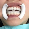 Bolsa Dental