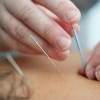 Bu Tong Acupuncture