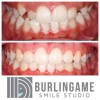 Burlingame Smile Studio