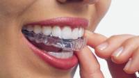 Invisalign