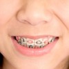 Stein Orthodontics