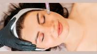 Microneedling