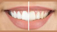 Cosmetic Dentistry