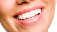 Tooth Whitening