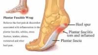 Heel Pain